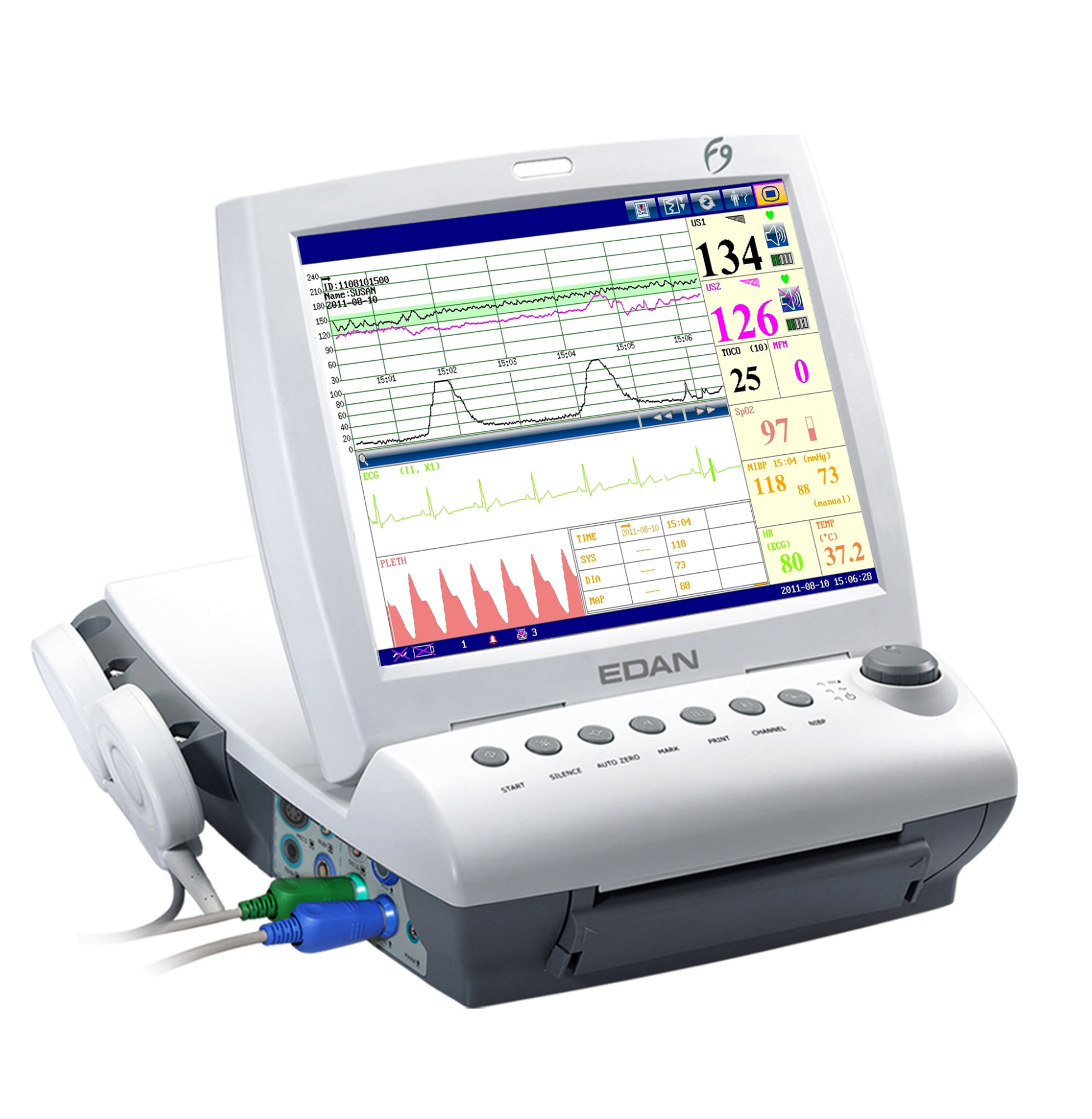 F9 Fetal & Maternal Monitor